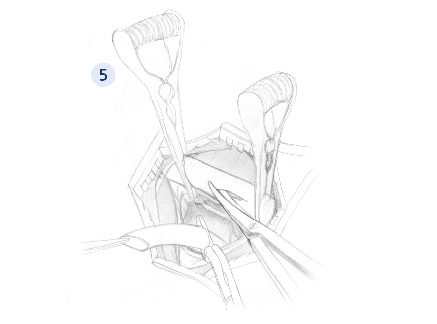 sketch5